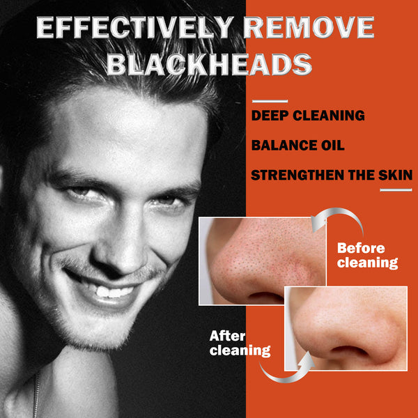 Blackhead Buster Nose Strips